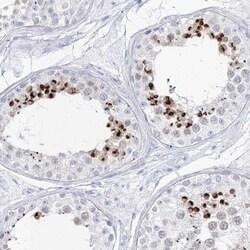Intra Acrosomal Protein Antibody, Novus Biologicals:Antibodies:Primary