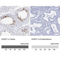 Intra Acrosomal Protein Antibody, Novus Biologicals:Antibodies:Primary