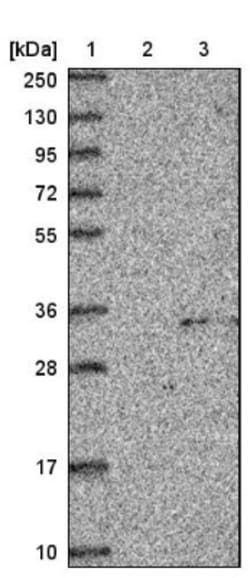 Intra Acrosomal Protein Antibody, Novus Biologicals 0.1mL; Unlabeled:Antibodies,