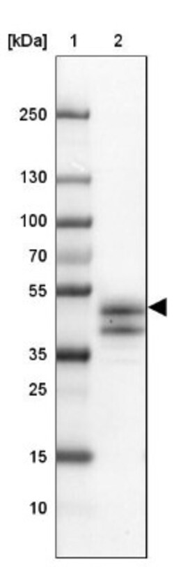 Intra Acrosomal Protein Antibody, Novus Biologicals:Antibodies:Primary