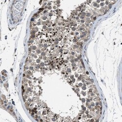 Invadolysin Antibody, Novus Biologicals 25 &mu;L, Unconjugated:Antibodies,
