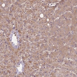 Irisin/FNDC5 Antibody, Novus Biologicals 0.1mL; Unlabeled:Antibodies, Polyclonal