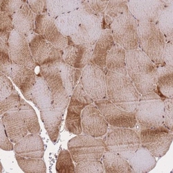 Irisin/FNDC5 Antibody, Novus Biologicals 0.1mL; Unlabeled:Antibodies, Polyclonal