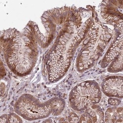 Irisin/FNDC5 Antibody, Novus Biologicals 0.1mL; Unlabeled:Antibodies, Polyclonal