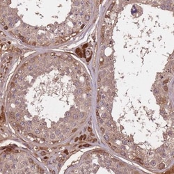 Irisin/FNDC5 Antibody, Novus Biologicals 0.1mL; Unlabeled:Antibodies, Polyclonal