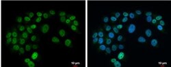 Islet-1 Antibody, Novus Biologicals 0.1mL; Unlabeled:Antibodies, Polyclonal