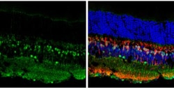 Islet-1 Antibody, Novus Biologicals™