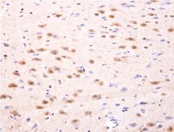 Islet-1 Antibody, Novus Biologicals 0.1mL; Unlabeled:Antibodies, Polyclonal