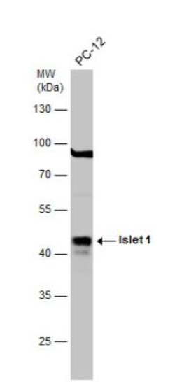 Islet-1 Antibody, Novus Biologicals 0.1mL; Unlabeled:Antibodies, Polyclonal