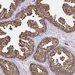 Isocitrate Dehydrogenase 1/IDH1 Antibody, Novus Biologicals 0.1mL; Unlabeled:Antibodies,