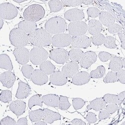 Isocitrate Dehydrogenase 1/IDH1 Antibody, Novus Biologicals 0.1mL; Unlabeled:Antibodies,