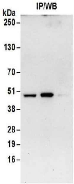 Isocitrate Dehydrogenase 1/IDH1 Antibody, Novus Biologicals 0.1mg; Unlabeled:Antibodies,