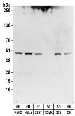 Isocitrate Dehydrogenase 1/IDH1 Antibody, Novus Biologicals 0.1mg; Unlabeled:Antibodies,