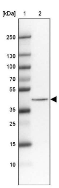 Isocitrate Dehydrogenase 1/IDH1 Antibody, Novus Biologicals 0.1mL; Unlabeled:Antibodies,
