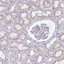 JAM-4/IGSF5 Antibody, Novus Biologicals:Antibodies:Primary Antibodies