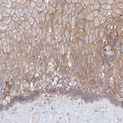 JAM-A Antibody, Novus Biologicals 0.1mL; Unlabeled:Antibodies, Polyclonal