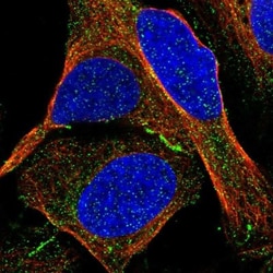 JCAD Antibody, Novus Biologicals:Antibodies:Primary Antibodies