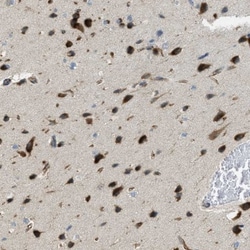 JCAD Antibody, Novus Biologicals:Antibodies:Primary Antibodies