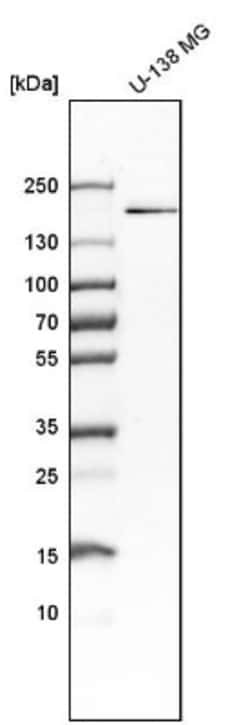 JCAD Antibody, Novus Biologicals:Antibodies:Primary Antibodies