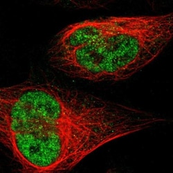 JHDM1D Antibody, Novus Biologicals:Antibodies:Primary Antibodies