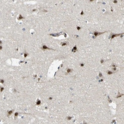JHDM1D Antibody, Novus Biologicals:Antibodies:Primary Antibodies