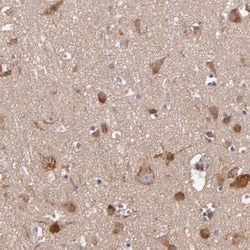 JM4 Antibody, Novus Biologicals:Antibodies:Primary Antibodies