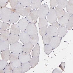 JM4 Antibody, Novus Biologicals:Antibodies:Primary Antibodies