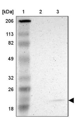 JM4 Antibody, Novus Biologicals:Antibodies:Primary Antibodies