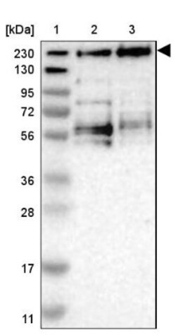 JMJD1B Antibody, Novus Biologicals:Antibodies:Primary Antibodies