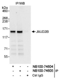 JMJD2B Antibody, Novus Biologicals 0.1mg; Unlabeled:Antibodies, Polyclonal