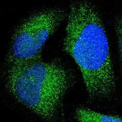 JMJD7 Antibody, Novus Biologicals:Antibodies:Primary Antibodies
