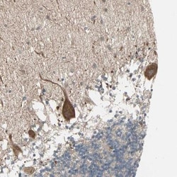 JMJD7 Antibody, Novus Biologicals:Antibodies:Primary Antibodies