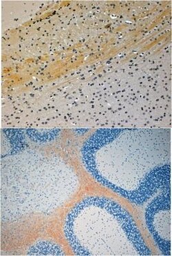 JNK/JIP3 Antibody, Novus Biologicals 0.1mg; Unlabeled:Antibodies, Polyclonal