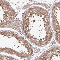 JNK/JIP3 Antibody, Novus Biologicals 25 &mu;L, Unlabeled:Antibodies, Polyclonal