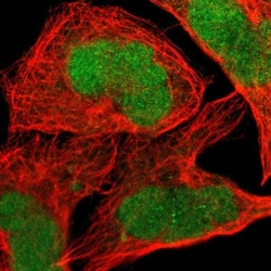 JPH1 Antibody, Novus Biologicals 0.1mL; Unlabeled:Antibodies, Polyclonal