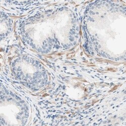 JPH1 Antibody, Novus Biologicals 0.1mL; Unlabeled:Antibodies, Polyclonal