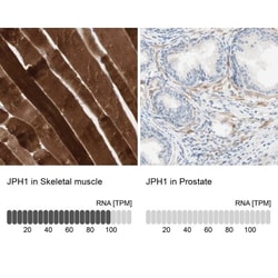 JPH1 Antibody, Novus Biologicals 0.1mL; Unlabeled:Antibodies, Polyclonal
