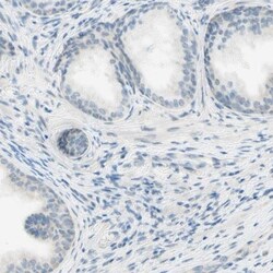 JPH1 Antibody, Novus Biologicals:Antibodies:Primary Antibodies