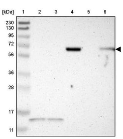 JPH1 Antibody, Novus Biologicals 0.1mL; Unlabeled:Antibodies, Polyclonal