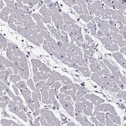 JSRP1 Antibody, Novus Biologicals 25 &mu;L | Buy Online | Novus Biologicals | Fisher Scientific