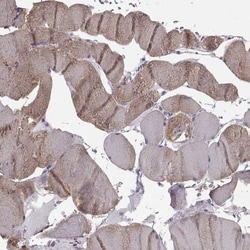 JSRP1 Antibody, Novus Biologicals 25 &mu;L | Buy Online | Novus Biologicals | Fisher Scientific