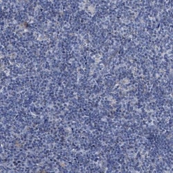 Jagged 1 Antibody, Novus Biologicals:Antibodies:Primary Antibodies