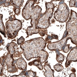 Jagged 2 Antibody, Novus Biologicals 0.1mL; Unlabeled:Antibodies, Polyclonal