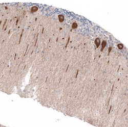 Jagged 2 Antibody, Novus Biologicals 0.1mL; Unlabeled:Antibodies, Polyclonal