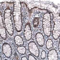 JunB/AP-1 Antibody, Novus Biologicals 0.1mL; Unlabeled:Antibodies, Polyclonal