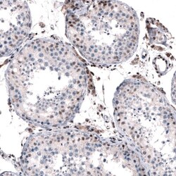 JunB/AP-1 Antibody, Novus Biologicals 0.1mL; Unlabeled:Antibodies, Polyclonal