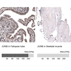 JunB/AP-1 Antibody, Novus Biologicals 0.1mL; Unlabeled:Antibodies, Polyclonal