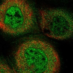 K0100 Antibody, Novus Biologicals:Antibodies:Primary Antibodies