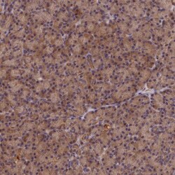 K0100 Antibody, Novus Biologicals:Antibodies:Primary Antibodies