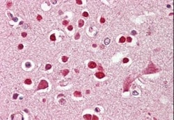 KA2/GRIK5/Glutamate Receptor KA2 Antibody, Novus Biologicals 0.1mg; Unlabeled:Antibodies,